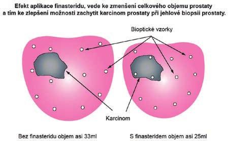 Obr. 4.