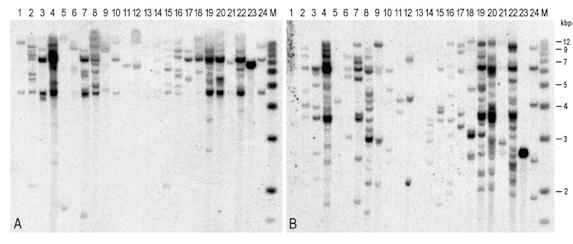 TRANSFORMACE SMRKU ZTEPILÉHO (PICEA ABIES (L.) KARST.) Obr. 2. Příklad analýzy transgenního embryogenního pletiva (EM) pomocí Southernovy hybridizace.