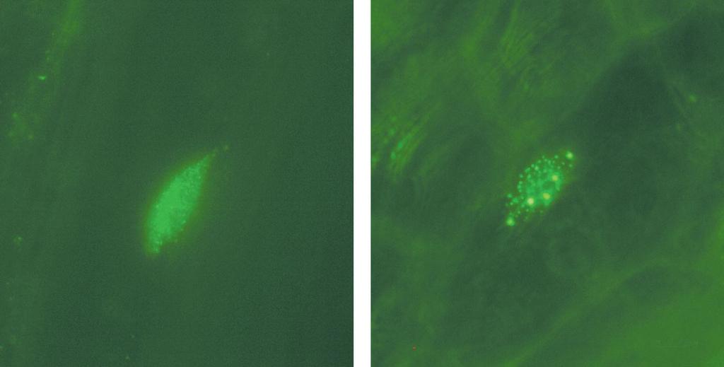 27 Fytochrom funguje v jádře aktivuje transkripční faktory. Je však lokalizovaný původně v cytoplazmě => musí být přemísťěn do jádra. Sharma R (2001) Current Science 80: 178-188 http://www.ias.ac.