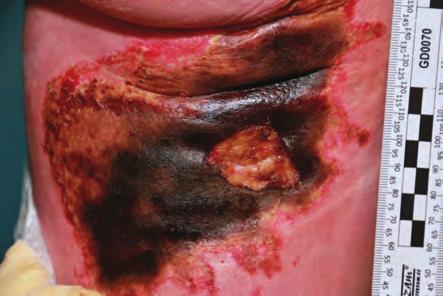 illicit laboratories represent considerable risks not only themselves, but also their mutual chemical reactions.