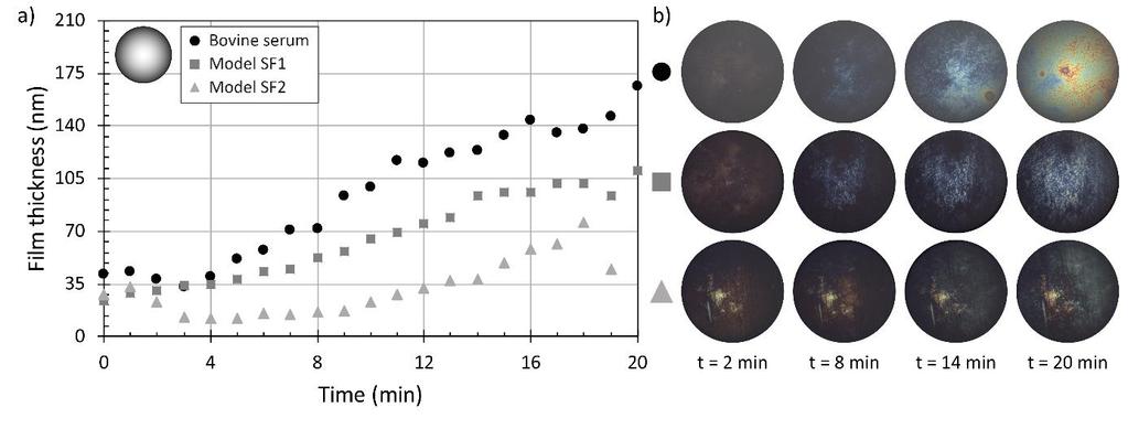 PŘEHLED SOUČASNÉHO STAVU POZNÁNÍ Test fluid Albumin γ-globulin HA Phospholipids Total protein concentration Volume (mg/ml) (mg/ml) (mg/ml) (mg/ml) (mg/ml) (ml) 25% BS Unknown Unknown - - 22.