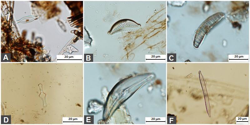 Příloha č. 11: Vybrané druhy rozsivek (A Synedra parasitica var.