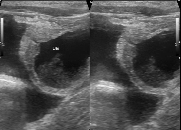 KAPITOLA 2. ULTRAZVUKOVÁ DIAGNOSTIKA 59 Obrázek 2.