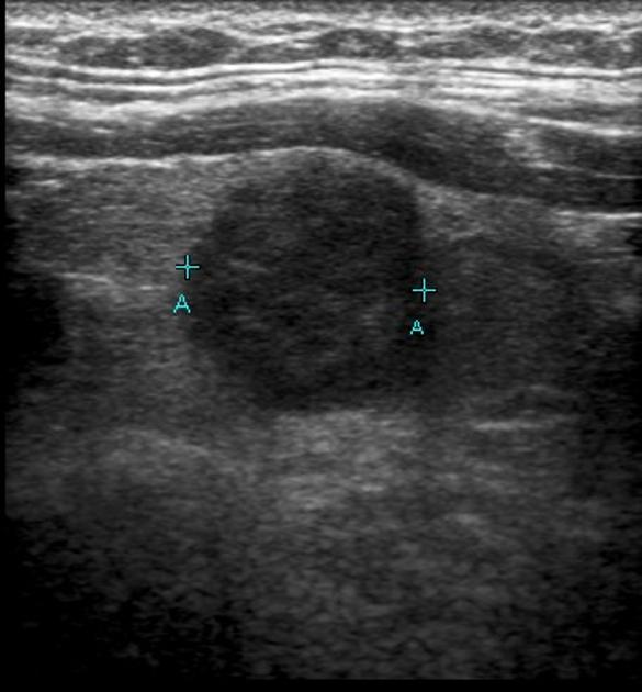 KAPITOLA 2. ULTRAZVUKOVÁ DIAGNOSTIKA 61 Obrázek 2.
