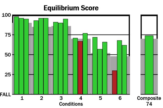 U testů č. 5 a č. 6, během kterých je omezena somatosenzorická složka stability i zraková kontrola, jsou výkyvy COG větší než u testu č. 4, kde je ponechána možnost zrakové kontroly.