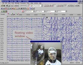 Video-EEG