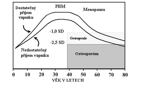 KOST JE METABOLICKY AKTIVNÍ TKÁŇ 90 % kostní hmoty se vytváří ke konci dospívání V prvních 5 6 letech života je pro kostní novotvorbu využito kolem 100 mg vápníku denně, během puberty až 400 mg Ca