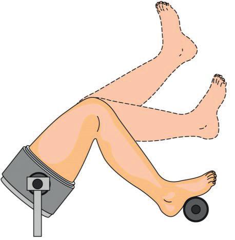 Rekonstrukce ACL metodou ST-G.