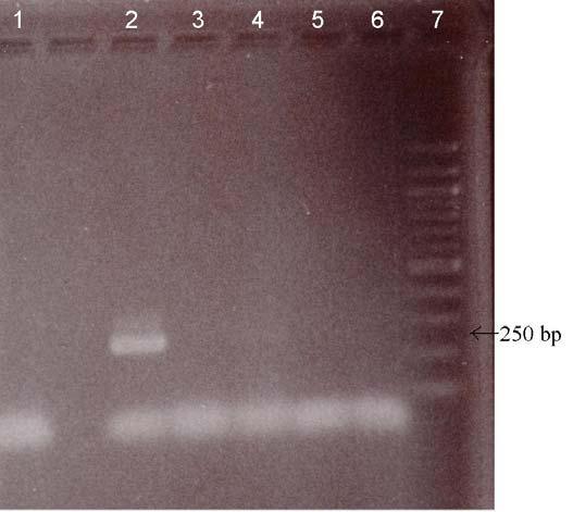 Ve všech výrobcích nebyla v eluátech přítomnost DNA detekována. Koncentrace DNA byla menší než 35 ng/20 µl tedy menší než 1,7 ng/µl. Množství DNA může být postačující pro PCR. 4.