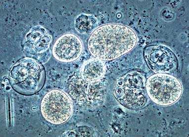 Naked amoebae -velmi malé, <30µm, žijí na povrchu
