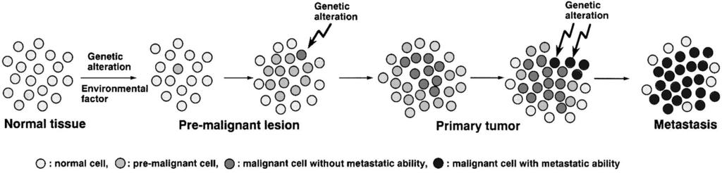 Postupná maligní progrese nádoru spojená s akumulací genetických změn v buňkách Genetická změna +