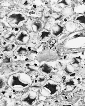 cytostatik, hormonů nebo vitamínů, v soudním lékařství ke stanovení toxických látek, dále protilátek proti alergenům apod.