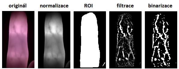Filtr pro zvýraznění žil I při použití transmisní metody snímání mají žíly oproti okolní tkáni nízký kontrast, který neumožňuje jejich přímou grafickou extrakci.