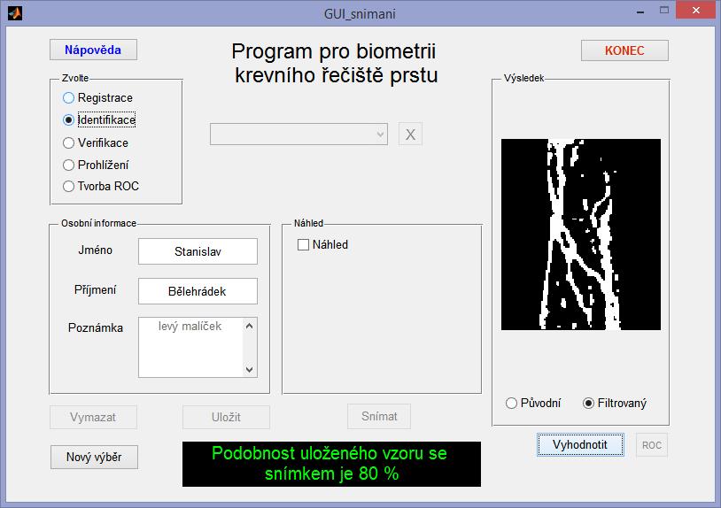 5.3. Implementace navržených metod do programu Program pro biometrické zpracování snímků prstu z webkamery přípravku je součástí grafického rozhraní (Obr. 22), vytvořeného v prostředí GUIDE MATLABu.