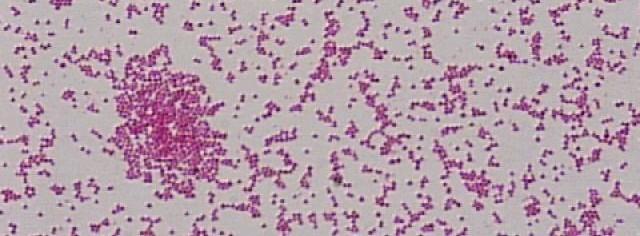 com Tyčinky Propionibacterium*** Eubacterium Actinomyces Bifidobacterium Lactobacillus G- Veillonella