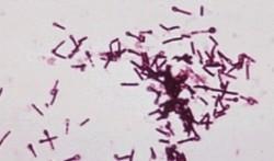 Přehled zločinců: Clostridium