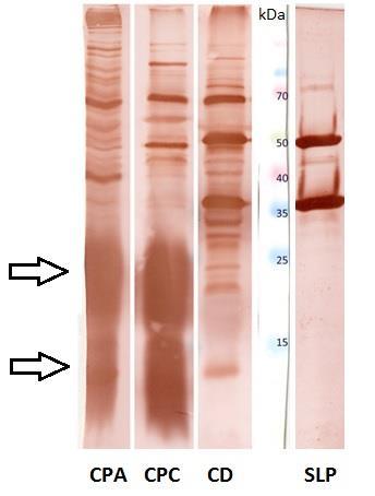 3.5. Westernbloting Celobuněčný lyzát bakterií C. difficile, C. perfringens typ A a C.