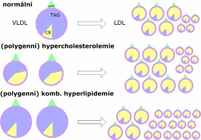 Lipoproteinový profil možnosti 33 Běžné aterogenní dyslipidemie polygenní hypercholesterolemie, fam.