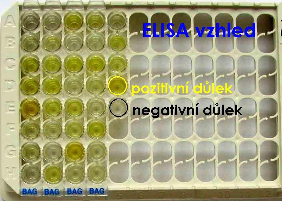 Ukázka jiné serologické