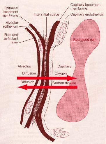 4. PATOFYZIOLOGIE difuzní alveolární postižení zvýšená permeabilita plicních kapilár,