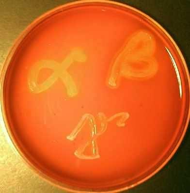 mikroby podle určité vlastnosti Příkladem je krevní agar ke sledování