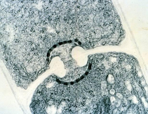 oddělení Basidiomycota karyogamie a meioza probíhá
