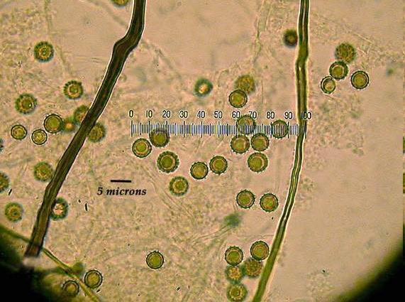 břichatkovité houby - mikroskopické znaky - peridie - přezky