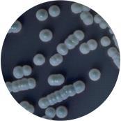 Candida albicans Candida tropicalis (častý výskyt u