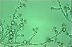 rezistentní k amfotericinu), Candida dubliniensis,