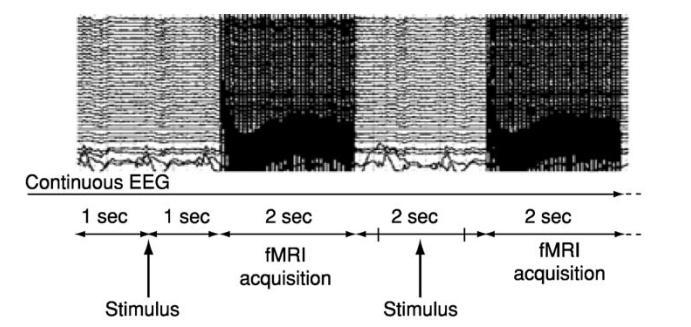 spojité EEG 1 s 1 s 2 s 2 s 2 s Akvizice fmri Akvizice fmri Stimul Stimul Obrázek 7: Intervalový režim při simultánním měření EEG/fMRI [13] Spojitý režim musí s gradientním zkreslením počítat.