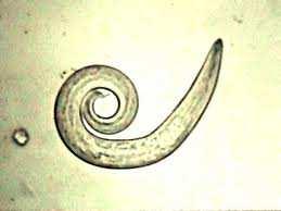 Obr. 9: Larva hlístice rodu Capilaria (http://www.google.