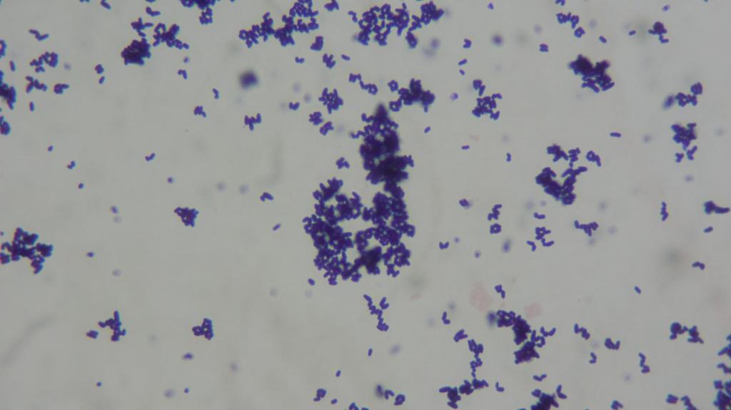 Korynebakteria Korynebakteria jsou grampozitivní tyčinky uspořádané v palisádách (vysvětlení viz dále).