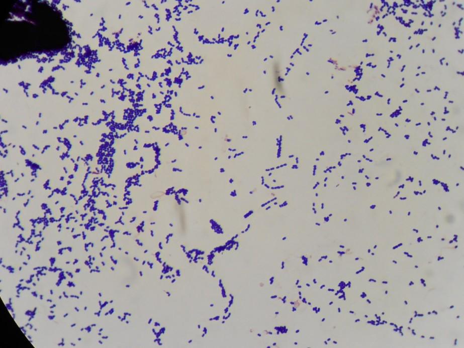 Streptococcus pyogenes strepto = v řetízcích, pyo-genes = hniso-tvorný Streptococcus pyogenes je známý jako původce angíny (akutní tonsilitidy). Způsobuje ale také hnisavé záněty tkání.