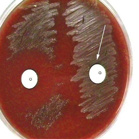 Optochinový test a další testy Klasický test k odlišení pneumokoka od ústních streptokoků. Pneumokok je citlivý na antibiotikum optochin, ústní streptokoky jsou rezistentní.