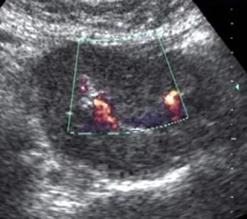 (55-82%), jejunum (11-25%), ileum (7-17%).