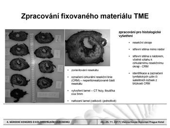 Od endoskopických