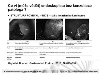 Pohled endoskopisty