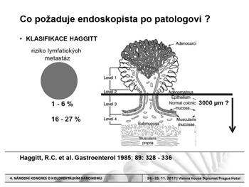 Pohled endoskopisty