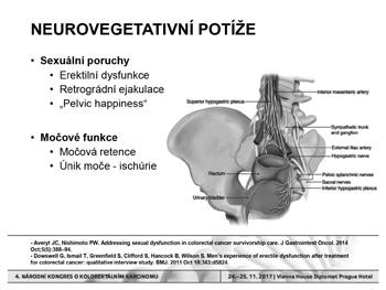 Komplikace v chirurgii