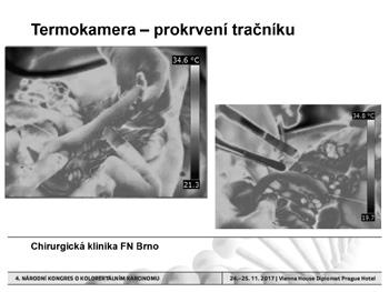 Komplikace v