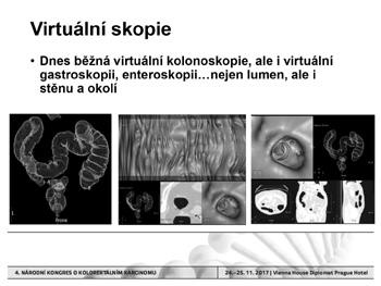 Zobrazovací metody: racionální využití v