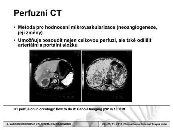 Zobrazovací metody: racionální využití v diagnostice a sledování kolorektálního