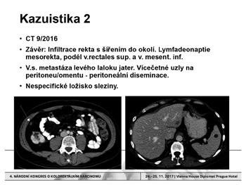 diagnostice a sledování