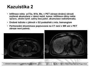 NÁRODNÍ KONGRES O