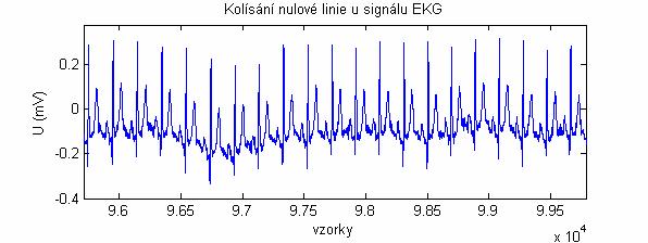 elektrochemických dějů probíhajících na rozhraní elektroda pokožka, případně dýchání pacienta. Frekvenční obsah tohoto šumu je obvykle až do 0.8Hz.