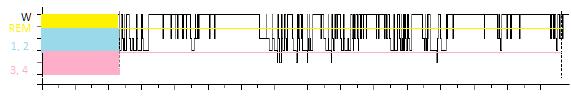 Délka spánku Schéma přednášky Krátký spánek < 7 hod obezita, DM2T, CVD, glc metab Spánková deprivace ghrelin, leptin, orexin neuronální aktivace vysokoenergetické jídlo HPA osa