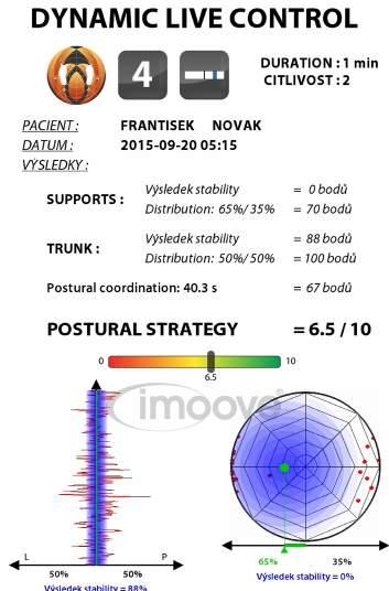Imoove je zařízení se širokým spektrem aplikací pro funkční rehabilitaci a medicínu.
