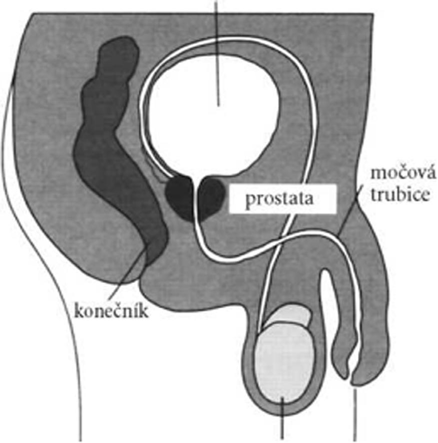 Co je prostata Prostata (předstojná žláza) je součást pohlavního mužského ústrojí. Je to oválná žláza, která obepíná počátek močové trubice pod močovým měchýřem.