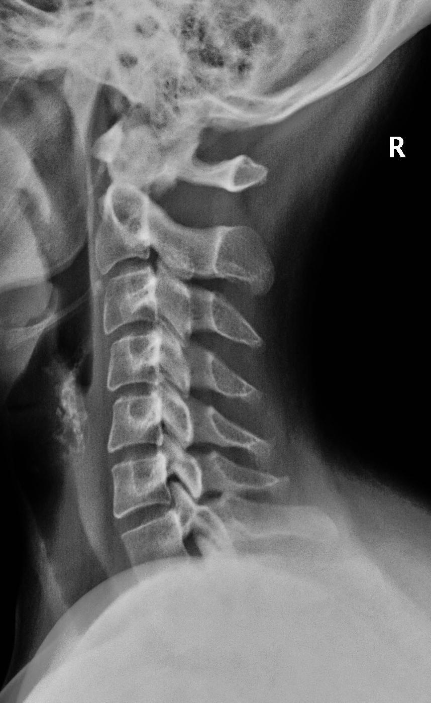 Zobrazování muskuloskeletálního systému 1 (radiologicko-anatomické  korelace) - PDF Stažení zdarma