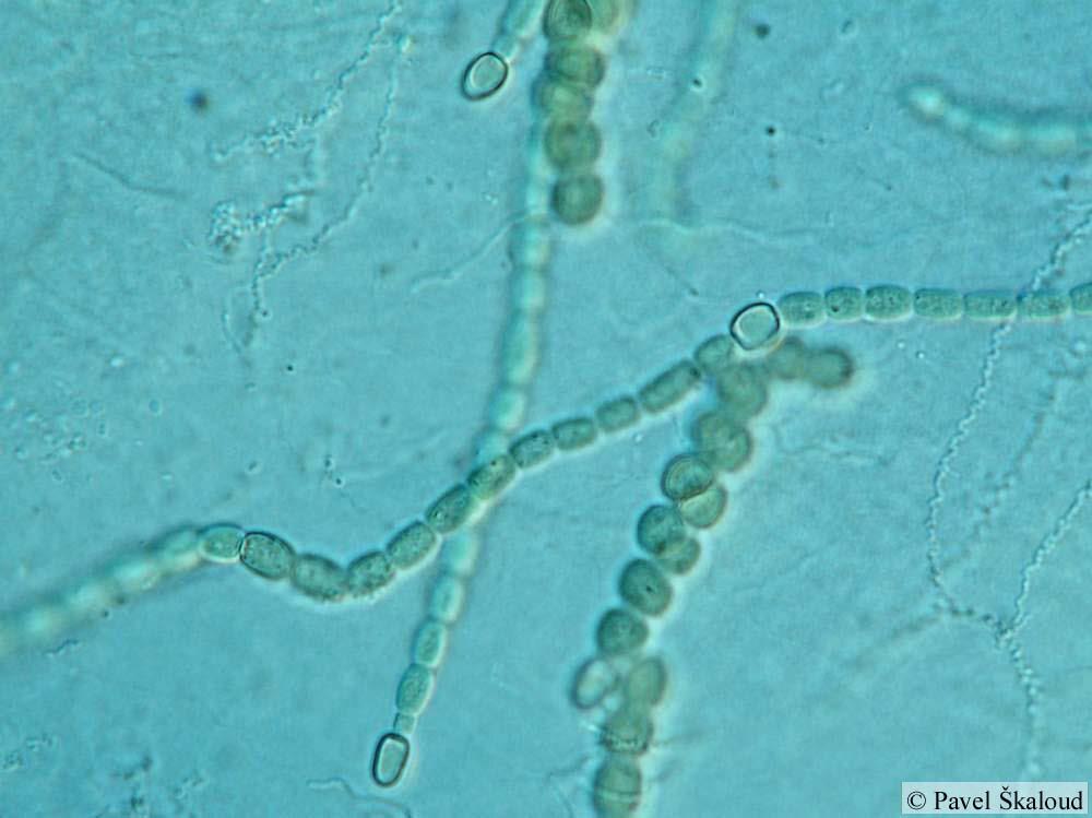 Nostoc calcicola Vláknitá sinice s heterocyty a